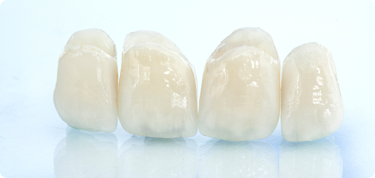 つめ物・かぶせ物